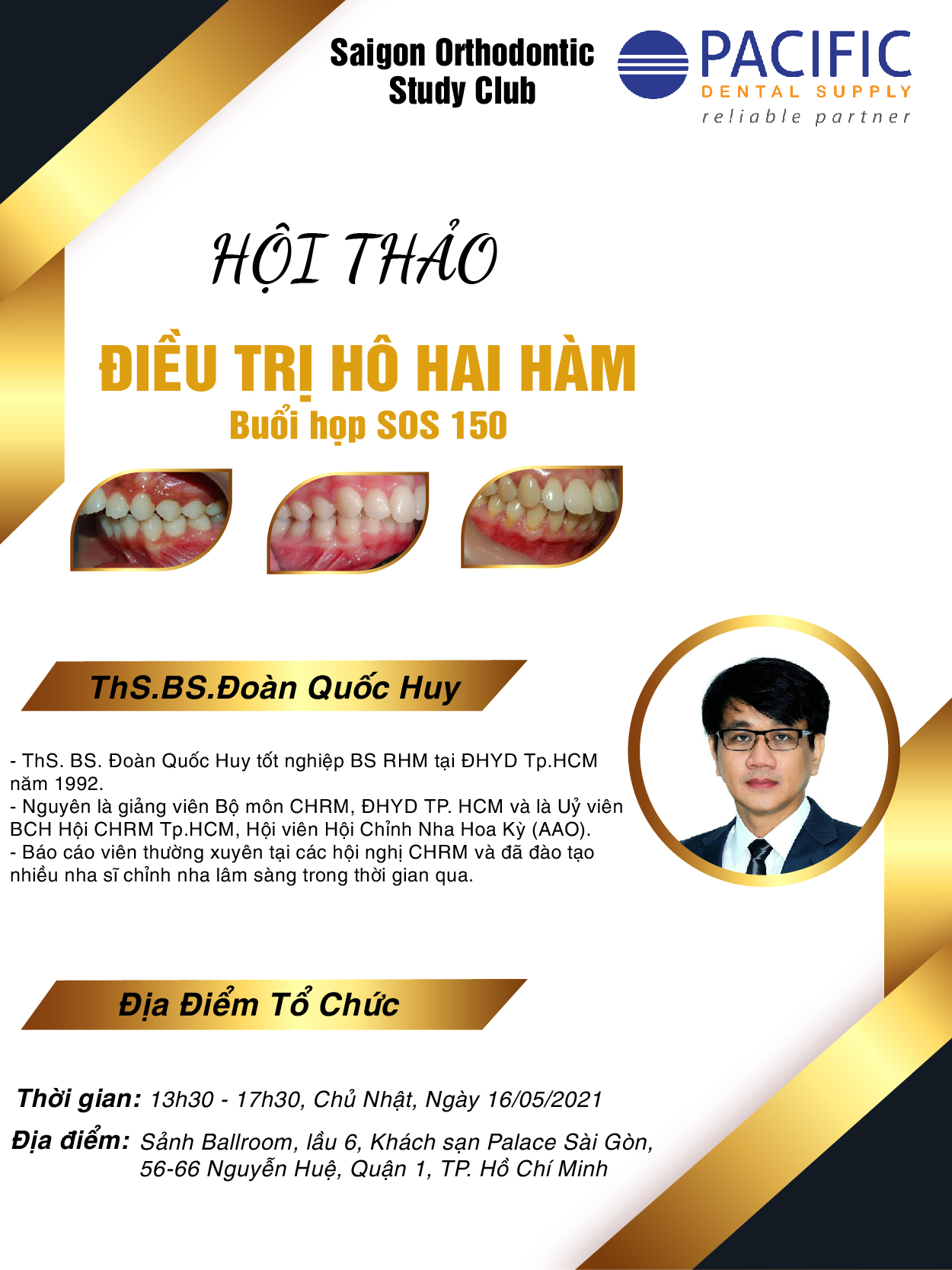 HỘI THẢO SOS LẦN THỨ 150 - ĐIỀU TRỊ HÔ HAI HÀM