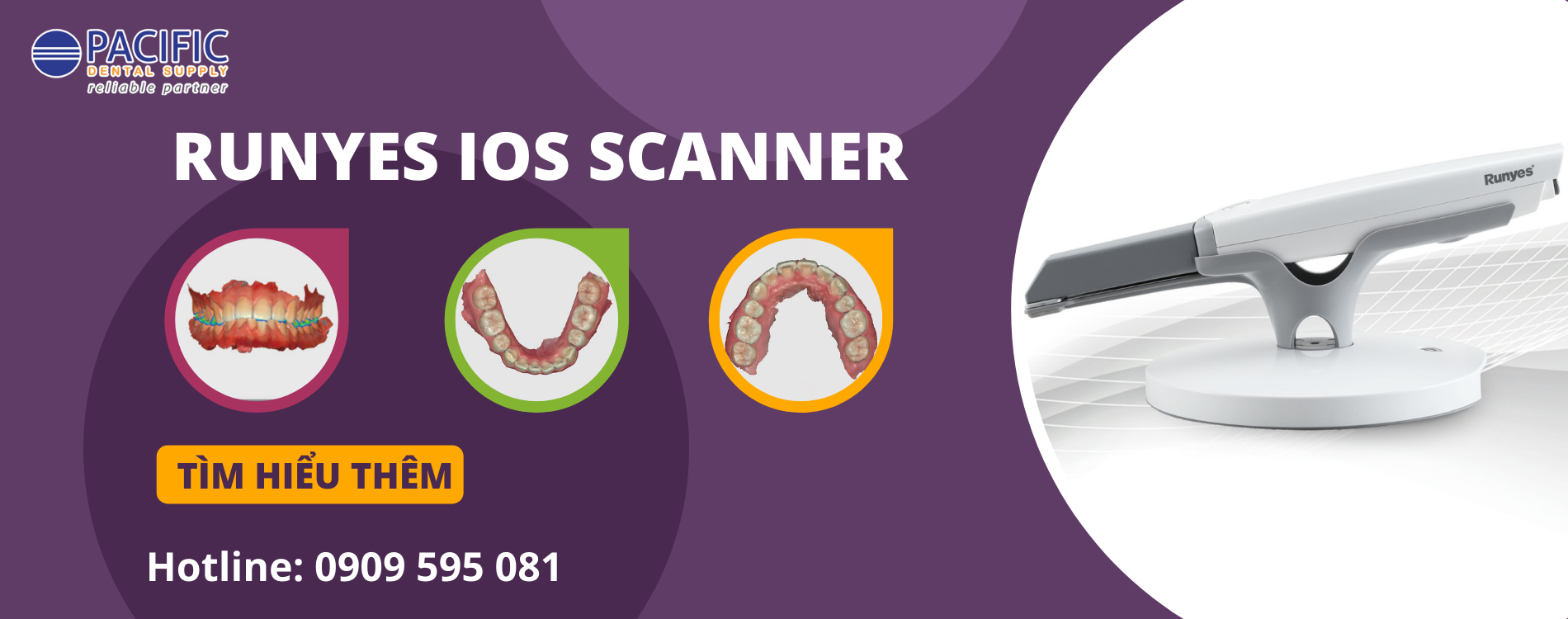 RunYes Scanner IOS 3DS: Đẳng cấp và xu hướng mới cho các phòng khám nha khoa